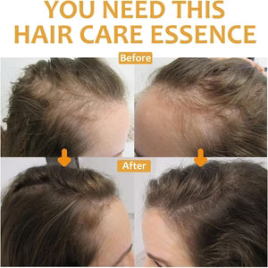 OUHOE Biotin Hair Growth Serum – Stronger & Healthier Hair سيروم OUHOE بالبيوتين لنمو الشعر – شعر أقوى وأكثر صحة